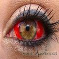 Hemorrhage II