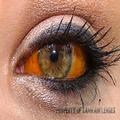 Jaundice