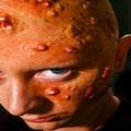Illusion Transfers Pimple and Skin Condition Appliances